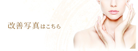 改善写真はこちら